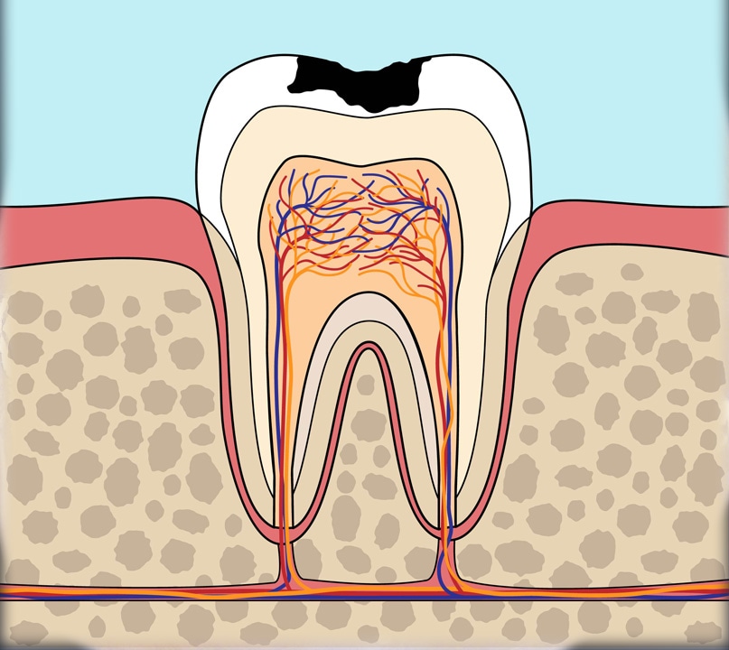 Disease Progression