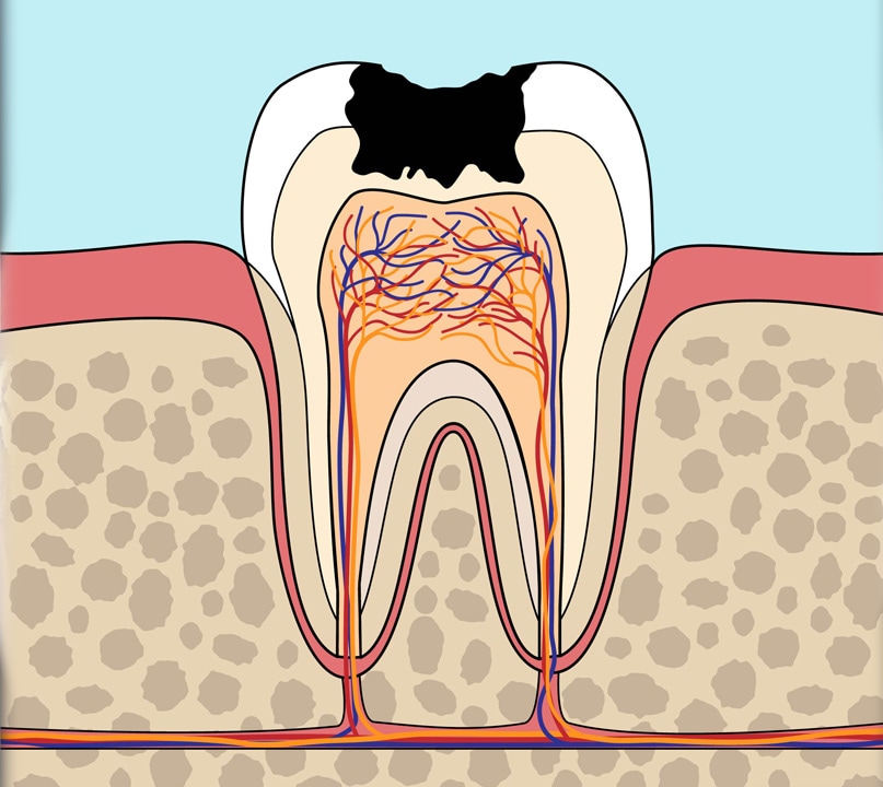 Disease Progression
