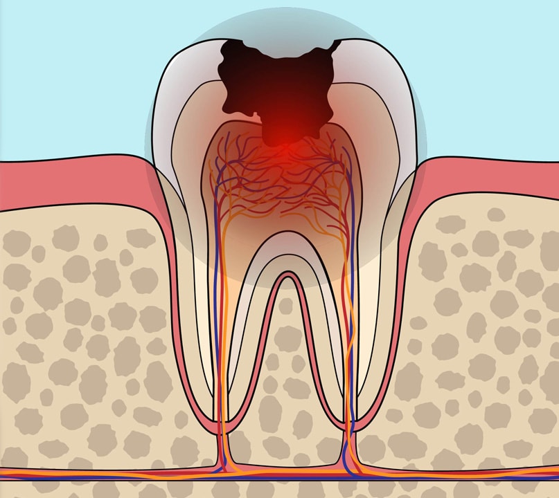 Disease Progression