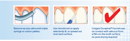 How it works durapath