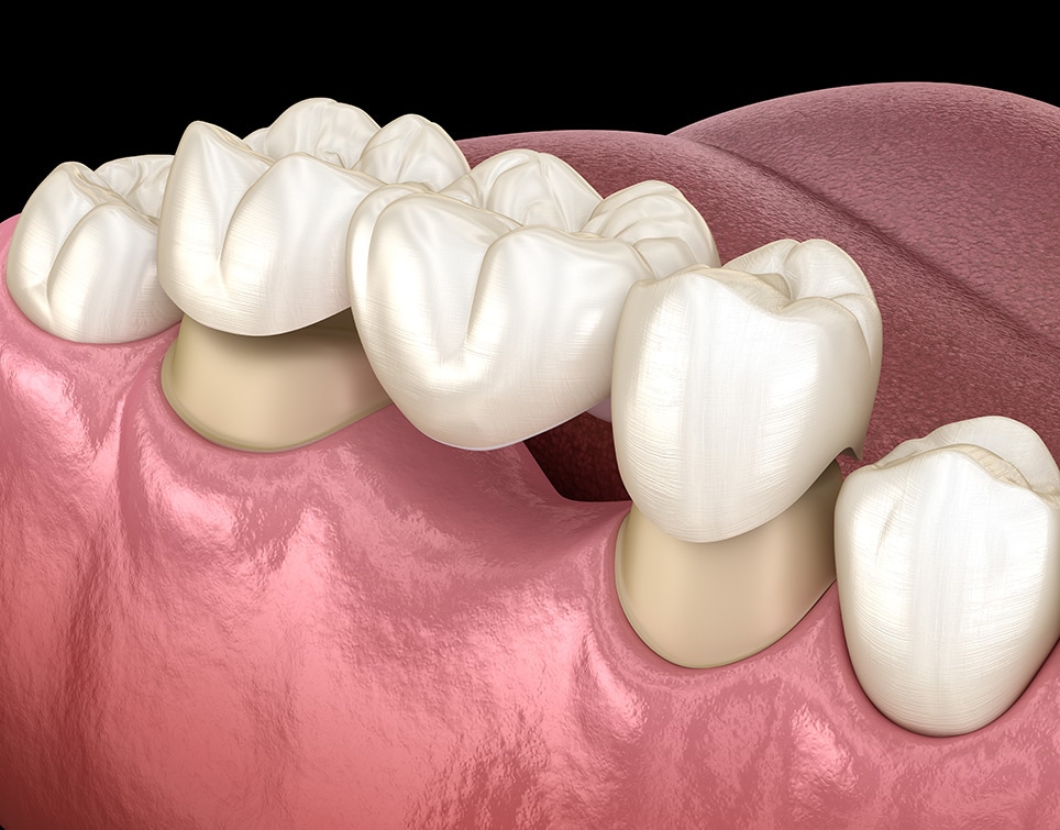 Man with toothache