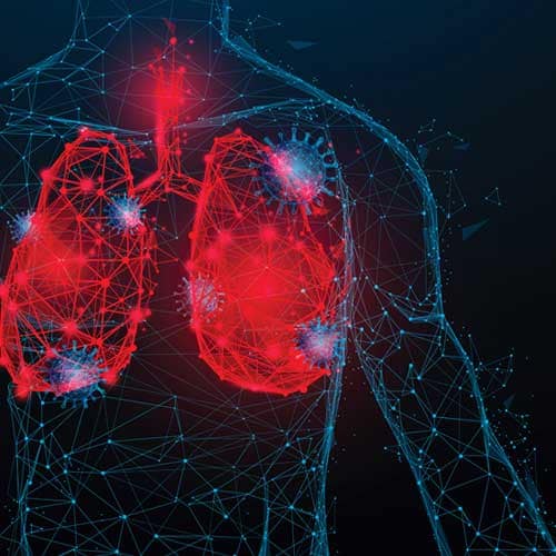 stylised-graphic-representing-coronavirus-in-the-respiratory-system